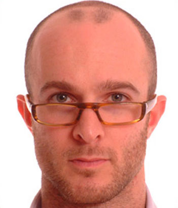 Starck Eyes P0315 glasses