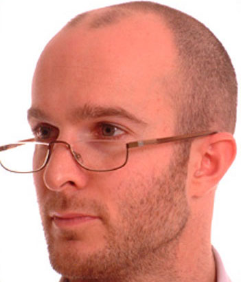 Starck Eyes P9904 glasses
